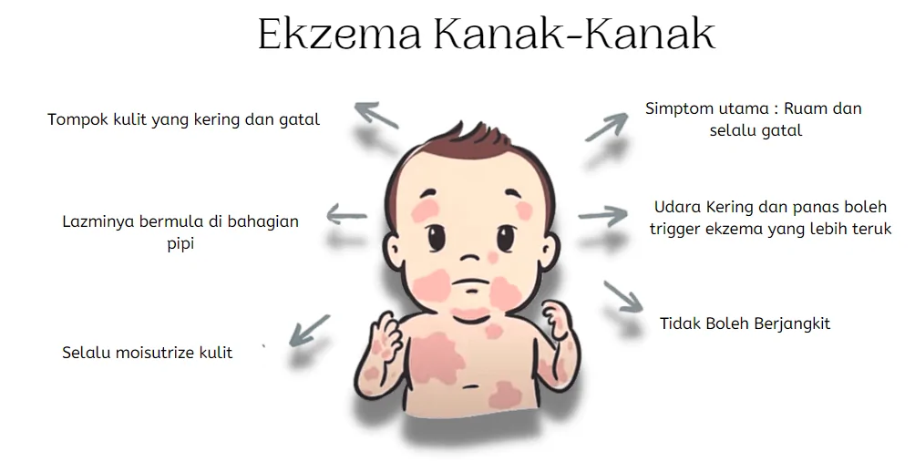 Tanda tanda dan rawatan ekzema
